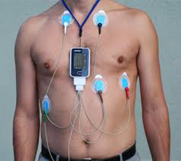 Conventional Holter Monitor