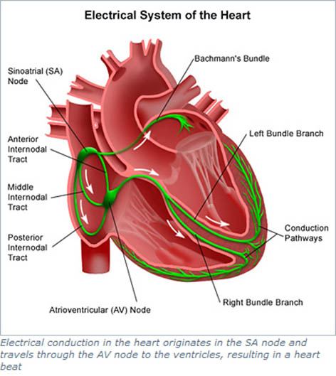 pacemaker image